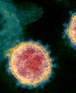 Le cellule T sviluppate con il raffreddore comune possono proteggere contro Sars-CoV-2